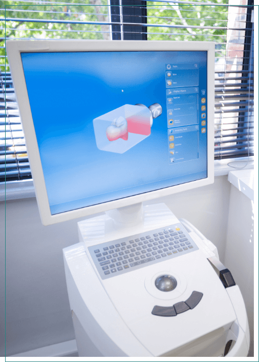 Digital model of teeth on computer monitor in dental treatment room