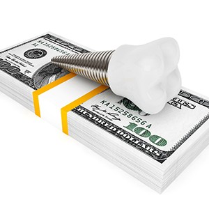 illustration of dental implant on top of a stack of money