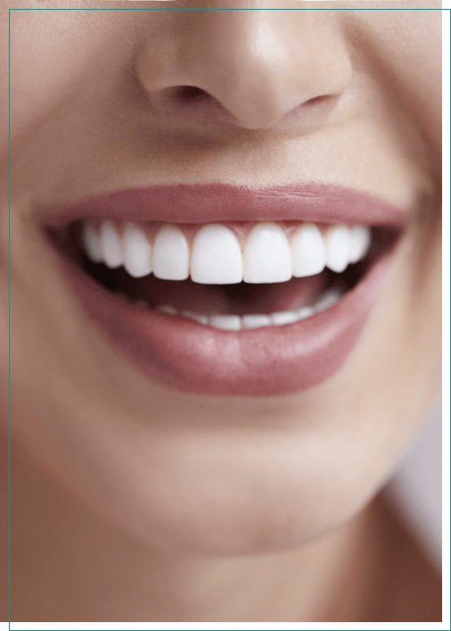 Close up of a smile with straight white teeth