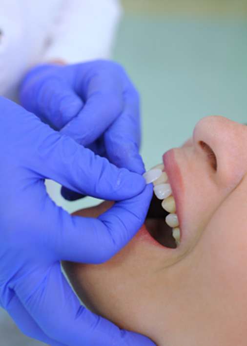 Woman getting veneers